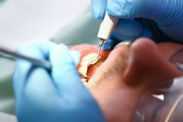 Best Pediatric Emergency Dentist in Burbank, CA